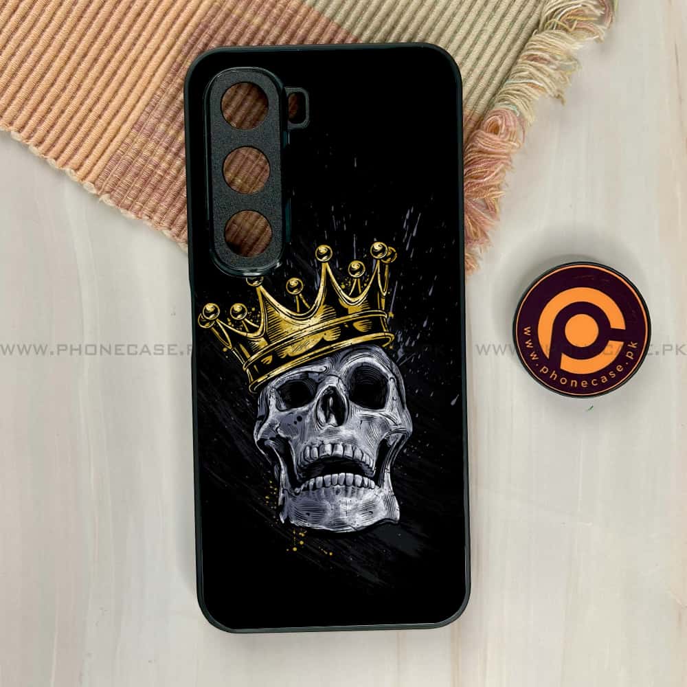 Infinix Hot 60i - King 2.0 Series - Premium Metal Printed soft Bumper shock Proof Case